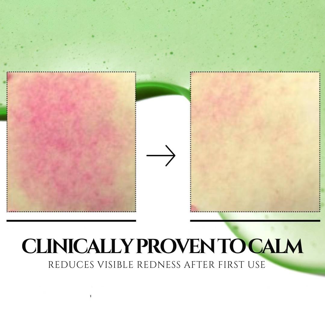 Azelaic Acid 10 Hyaluron Redness Soothing Serum - 30ml