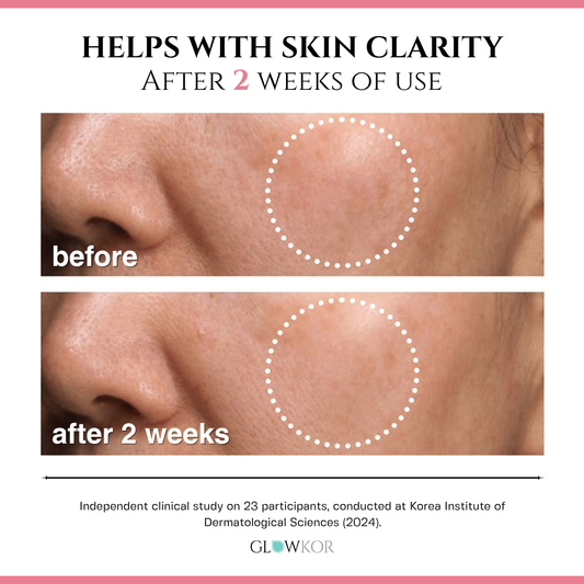 Anua - Niacinamide 10% + TXA 4% Dark Spot Correcting Serum