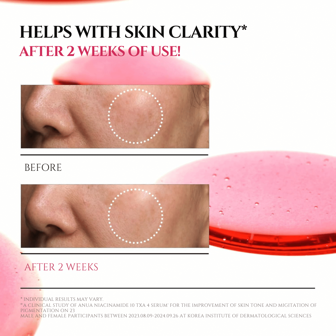 Niacinamide 10% + TXA 4% Dark Spot Correcting Serum