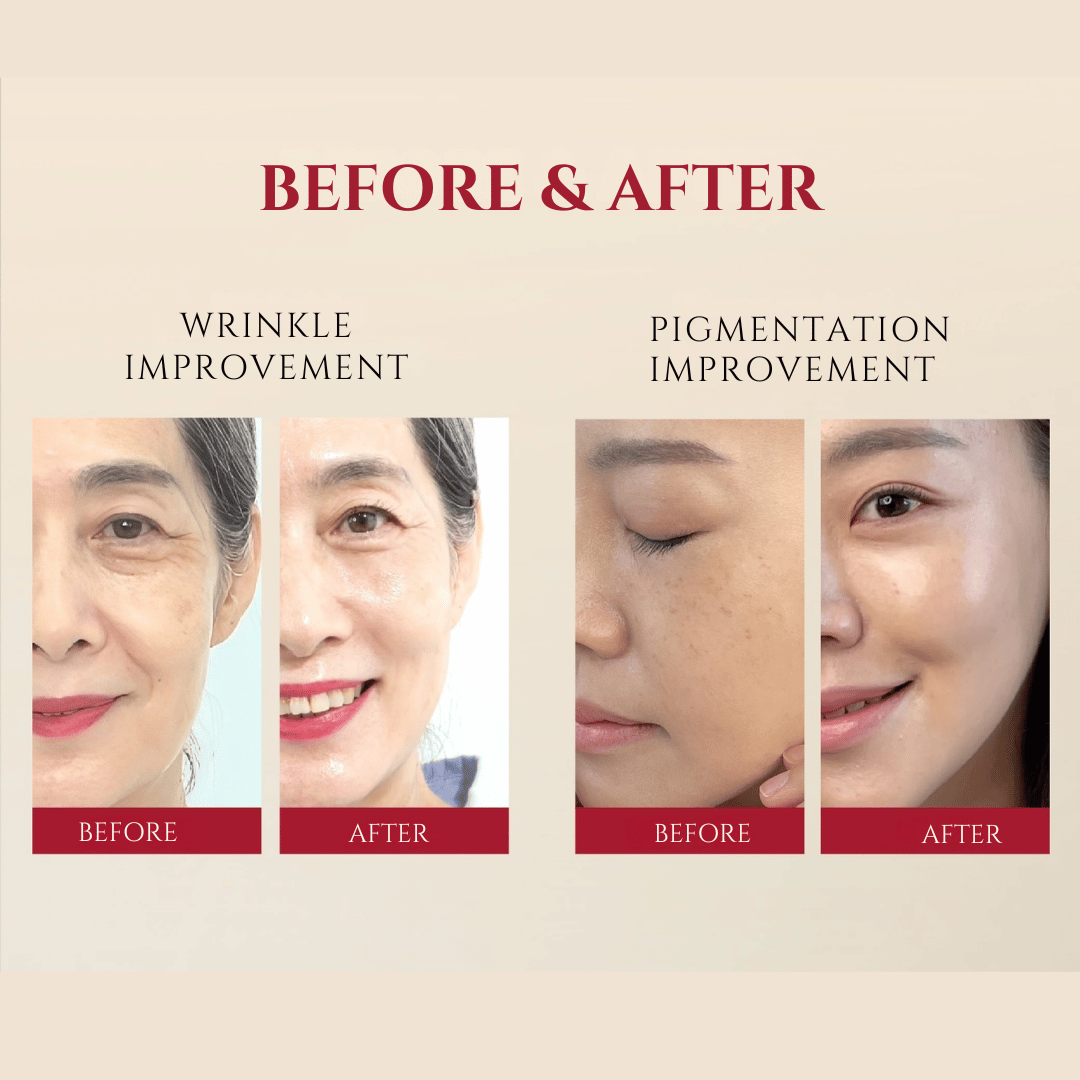 SEOUL 1988 Serum : Retinal Liposome 2% + Black Ginseng - 30mL