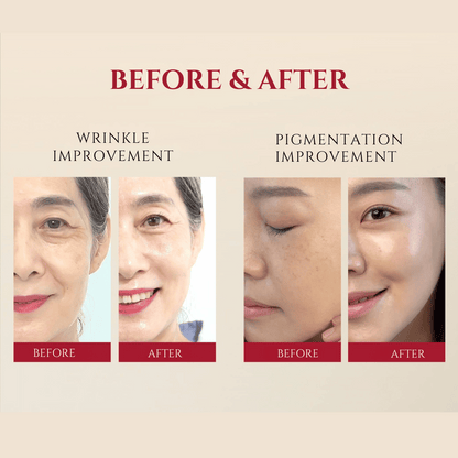 SEOUL 1988 Serum : Retinal Liposome 2% + Black Ginseng - 30mL